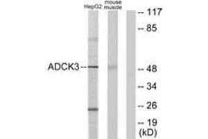 Western blot analysis of extracts from HepG2/mouse muscle cells, using ADCK3 Antibody. (COQ8A antibody  (AA 301-350))