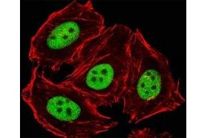 Fluorescent image of HeLa cells stained with GLI2 antibody diluted at 1:25 dilution. (GLI2 antibody  (C-Term))