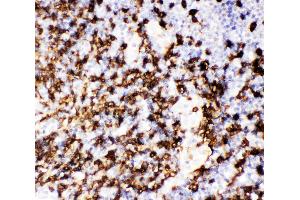 Anti-CD20 Picoband antibody,  IHC(P): Human Tonsil Tissue (CD20 antibody  (AA 1-261))