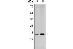 Western blot analysis of SUMO4 expression in Jurkat (A), MCF7 (B) whole cell lysates. (SUMO4 antibody)