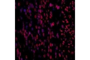 Immunofluorescent analysis of paraformaldehyde-fixed fetal mouse using,Mettl11a (ABIN7074612) at dilution of 1: 1500 (METTL11A antibody)