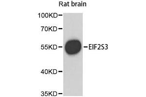 Western blot analysis of extracts of rat brain, using EIF2S3 antibody (ABIN1872488) at 1:1000 dilution.