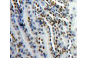 Used in DAB staining on fromalin fixed paraffin-embedded Kidney tissue (SNRPC antibody  (AA 2-159))