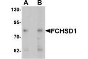Western blot analysis of FCHSD1 in MCF7 cell lysate with FCHSD1 Antibody  at (A) 0. (FCHSD1 antibody  (C-Term))