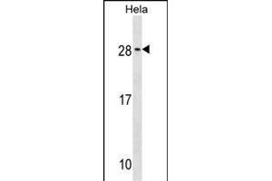 RAB35 Antibody (C-term) (ABIN1536778 and ABIN2849666) western blot analysis in Hela cell line lysates (35 μg/lane). (RAB35 antibody  (C-Term))