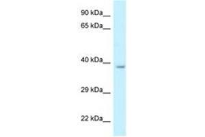 Image no. 1 for anti-Retinol Dehydrogenase 10 (All-Trans) (RDH10) (AA 242-291) antibody (ABIN6747672) (RDH10 antibody  (AA 242-291))