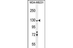 ZSWIM6 Antibody (C-term) (ABIN654590 and ABIN2844290) western blot analysis in MDA-M cell line lysates (35 μg/lane). (ZSWIM6 antibody  (C-Term))