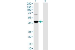 Western Blot analysis of PRPSAP1 expression in transfected 293T cell line by PRPSAP1 monoclonal antibody (M01), clone 5H10. (PRPSAP1 antibody  (AA 175-266))