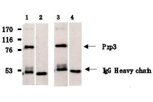 Western Blotting (WB) image for anti-PRP3 Pre-mRNA Processing Factor 3 Homolog (PRPF3) antibody (ABIN1449201) (PRPF3 antibody)