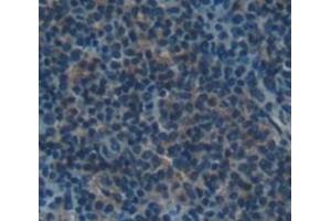Immunohistochemistry (IHC) image for anti-Complement Component (3d/Epstein Barr Virus) Receptor 2 (CR2) (AA 571-770) antibody (ABIN1858486)