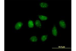 Immunofluorescence of purified MaxPab antibody to PLK1 on HeLa cell. (PLK1 antibody  (AA 1-603))