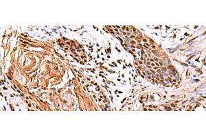 ITPR2 antibody