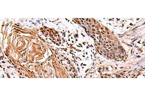 ITPR2 antibody