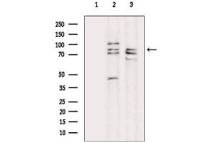 anti-FGFR1, FGFR2 antibody