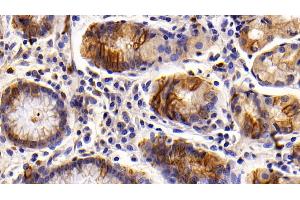 Detection of KRT6A in Human Stomach Tissue using Polyclonal Antibody to Keratin 6A (KRT6A) (KRT6A antibody  (AA 163-468))