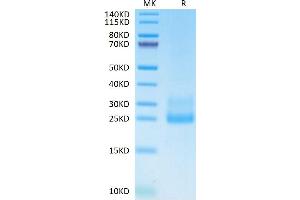 CD69 Protein (CD69) (AA 62-199) (His tag)