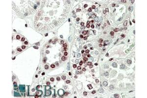 ABIN1590011 (5µg/ml) staining of paraffin embedded Human Kidney. (MAPKAP Kinase 5 antibody  (AA 192-206))