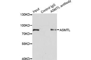 Immunoprecipitation analysis of 200ug extracts of SW620 cells using 1ug ASMTL antibody (ABIN2561248).