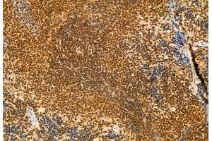 ABIN6261268 and ABIN6272941 at 1/100 staining Rat spleen tissue by IHC-P.