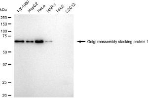 Western blotting analysis using Golgi reassembly stacking protein 1 antibody (ABIN7798795).
