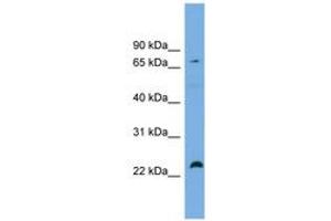 Image no. 1 for anti-Spastic Paraplegia 20 (Troyer Syndrome) (SPG20) (AA 431-480) antibody (ABIN6743807) (SPG20 antibody  (AA 431-480))