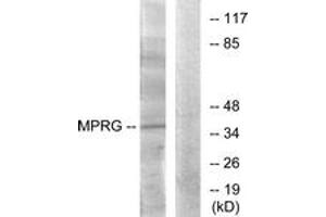 Western blot analysis of extracts from HuvEc cells, using MPRG Antibody. (PAQR5 antibody  (AA 281-330))