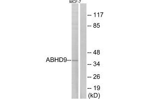 Western blot analysis of extracts from MCF-7 cells, using ABHD9 antibody. (ABHD9 antibody  (Internal Region))