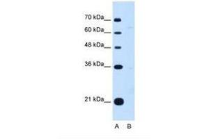 DONSON 抗体  (AA 301-350)