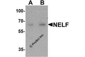 Western Blotting (WB) image for anti-NMDA Receptor Synaptonuclear Signaling and Neuronal Migration Factor (NSMF) antibody (ABIN1077438) (NMDA Receptor Synaptonuclear Signaling and Neuronal Migration Factor (NSMF) antibody)