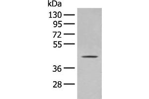 Western blot analysis of A375 cell lysate using OLA1 Polyclonal Antibody at dilution of 1:400 (OLA1 antibody)