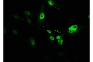 Immunofluorescence staining of U251 cells with ABIN7162672 at 1:166, counter-stained with DAPI. (PVALB antibody  (AA 2-110))
