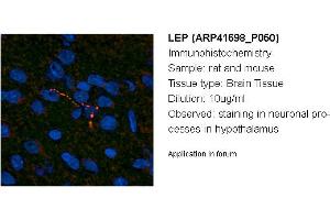 Image no. 1 for anti-Leptin (LEP) (Middle Region) antibody (ABIN2776944) (Leptin antibody  (Middle Region))