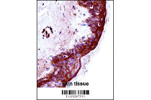 KLK9 Antibody immunohistochemistry analysis in formalin fixed and paraffin embedded human skin tissue followed by peroxidase conjugation of the secondary antibody and DAB staining. (Kallikrein 9 antibody  (AA 82-111))