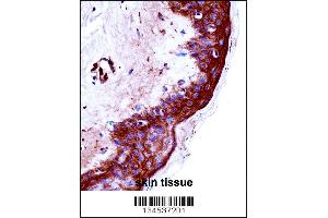 KLK9 Antibody immunohistochemistry analysis in formalin fixed and paraffin embedded human skin tissue followed by peroxidase conjugation of the secondary antibody and DAB staining.