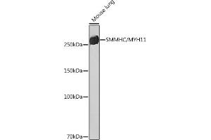Western blot analysis of extracts of Mouse lung, using SMMHC/SMMHC/MYH11 Rabbit mAb (ABIN7268745) at 1:1000 dilution. (MYH11 antibody)