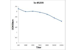 Antigen: 2 µg/100 µL  Primary: Antiserum, 1:500, 1:1000, 1:2000, 1:4000, 1:8000, 1:16000, 1:32000;  Secondary: HRP conjugated Rabbit Anti-Goat IgG at 1: 5000;  TMB staining Read the data in Microplate Reader by 450nm. (POLB antibody  (AA 55-160))