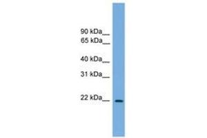 Image no. 1 for anti-Jun Dimerization Protein 2 (JDP2) (N-Term) antibody (ABIN6744612) (JDP2 antibody  (N-Term))