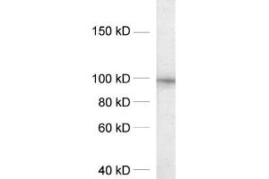 dilution: 1 : 1000, sample: crude synaptosomal fraction of rat brain (P2) (DLG2 antibody  (AA 22-37))