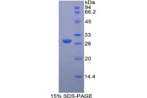 SDS-PAGE analysis of Mouse LOXL3 Protein. (LOXL3 Protein)