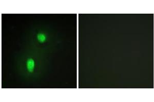 Immunofluorescence analysis of HUVEC cells, using hnRNP C1/C2 antibody. (HNRNPC antibody  (C-Term))