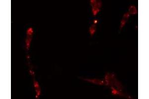 ABIN6275052 staining  A549 cells by IF/ICC. (APPL1 antibody  (Internal Region))