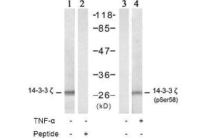 Image no. 2 for anti-14-3-3 zeta (YWHAZ) (pSer58) antibody (ABIN196916) (14-3-3 zeta antibody  (pSer58))