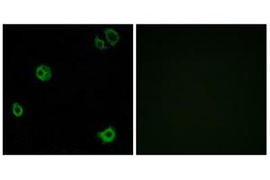 Immunofluorescence analysis of A549 cells, using GPR110 antibody. (G Protein-Coupled Receptor 110 antibody  (C-Term))