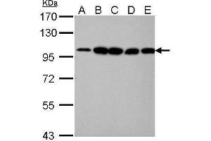 WB Image alpha Actinin 4 antibody [C2C3], C-term detects ACTN4 protein by Western blot analysis.