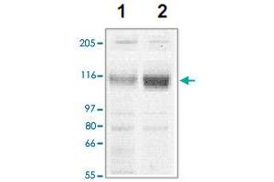 The tissue lysates derived from mouse heart (lane 1) or rat heart (lane 2) were immunoprobed by Corin polyclonal antibody  at 1 : 500. (Corin antibody  (C-Term))