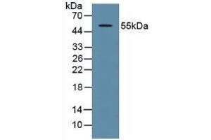 Detection of P53 in Human 293T Cells using Polyclonal Antibody to Tumor Protein p53 (P53) (p53 antibody  (AA 134-387))