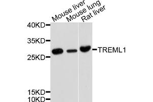 Western blot analysis of extracts of various cell lines, using TREML1 antibody (ABIN4905487) at 1:1000 dilution.