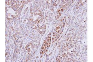 IHC-P Image Immunohistochemical analysis of paraffin-embedded A549 xenograft, using RPS10, antibody at 1:500 dilution.