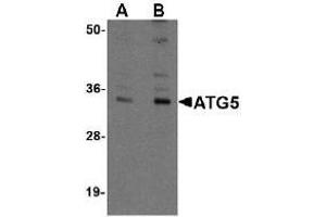 Western blot. (ATG5 antibody  (N-Term))