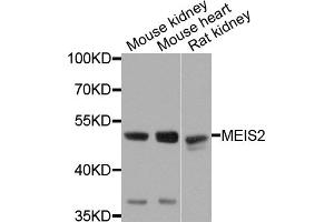 Western blot analysis of extracts of various cell lines, using MEIS2 antibody.